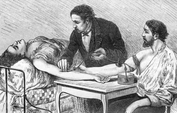 First Successful Blood Transfusion Performed by Dr. Albert Hustin